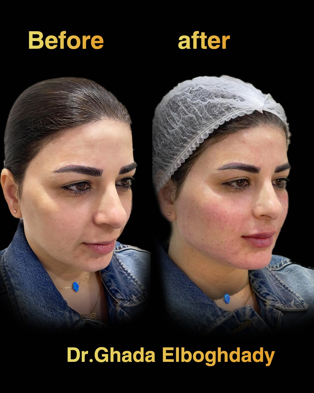 صورة ١ قبل وبعد .jpg